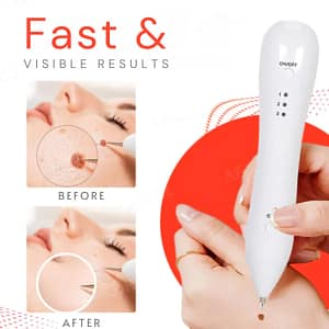 Fivfivgo™ Portable Skin Care Laser Pen