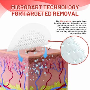 Fivfivgo® MicroDart Skin Tag Remover Patch