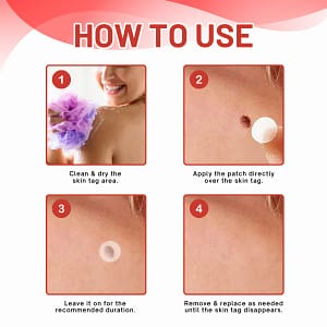 Fivfivgo® MicroDart Skin Tag Remover Patch