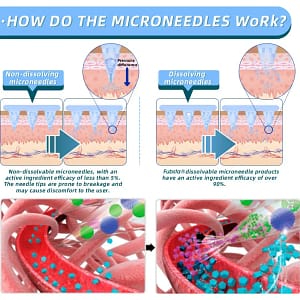 Lmipki® NIDDK-Tirzepatide Nano Microneedle Patch