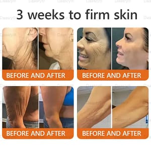 Daasry® “Dermal Gold” Botox Bee Venom Skin Restoration Cream