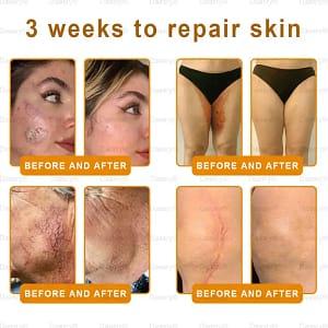 Daasry® “Dermal Gold” Botox Bee Venom Skin Restoration Cream