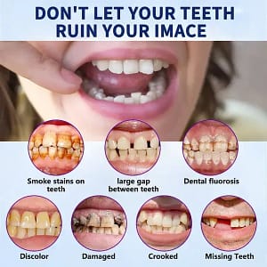 HZA™-Advanced Customized Full Denture Set