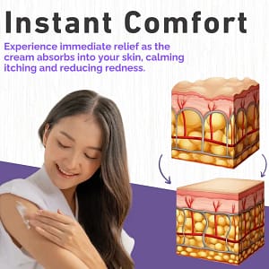 Cvreoz® Violet Eczema Treatment Cream