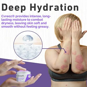 Cvreoz® Violet Eczema Treatment Cream