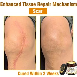 LOVILDS® Full-Body Repair Cream