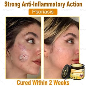 APKAPK™ Bee Venom Skin Treatment Cream