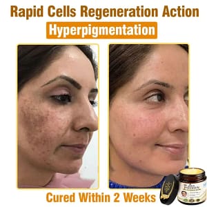 LOVILDS® Full-Body Repair Cream