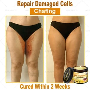 APKAPK™ Bee Venom Skin Treatment Cream
