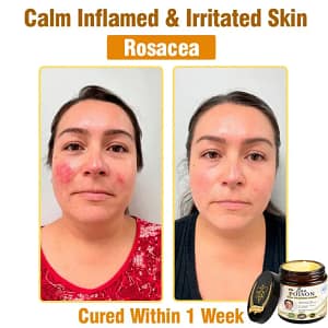 LOVILDS® Full-Body Repair Cream