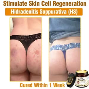 LOVILDS® Full-Body Repair Cream