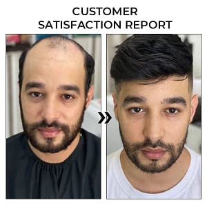 Fivfivgo™ BeeGrow Follicle Reviving Hair Essence