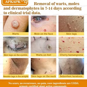 APKAPK™ Bee Venom Skin Treatment Cream