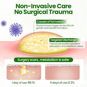 Fivfivgo® KnotAway Lipoma Removal Cream