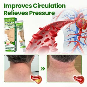Fivfivgo® KnotAway Lipoma Removal Cream