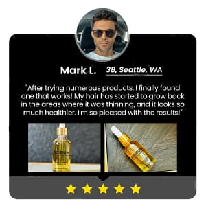 Fivfivgo™ BeeGrow Follicle Reviving Hair Essence