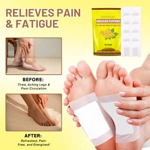 Fivfivgo™ Ultra Anti-Swelling Ginger Detoxing Patch