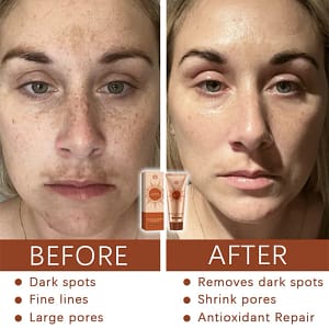 Fivfivgo™ Herbal Spots Peel-Off Facial Mask