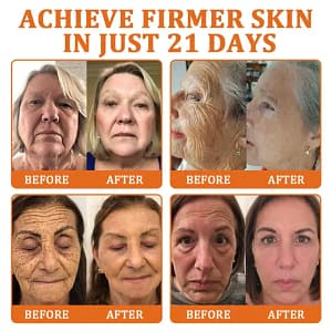 Flysmus Botox Bee Venom Treatment Serum Stick
