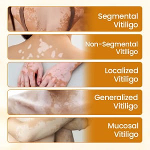 Timilk® VitiCalm Bee Venom Cream