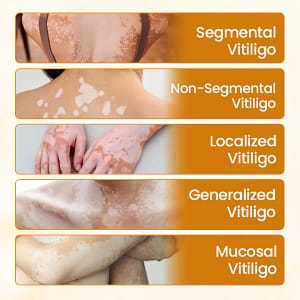 Fivfivgo® VitiCalm Bee Venom Cream
