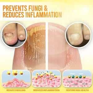 Fivfivgo® ClariNail Bee Venom Fungal Solution Drops