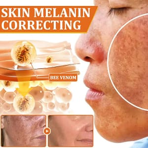 Flysmus Botox Bee Venom Treatment Serum Stick