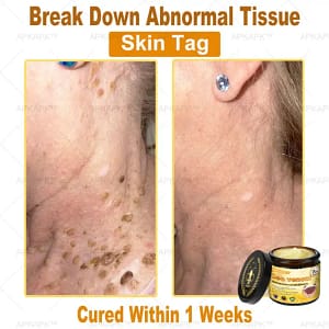 APKAPK™ Bee Venom Skin Treatment Cream