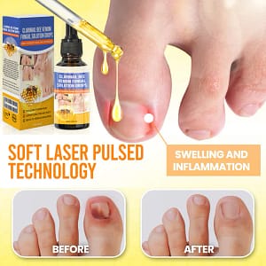 Fivfivgo® ClariNail Bee Venom Fungal Solution Drops
