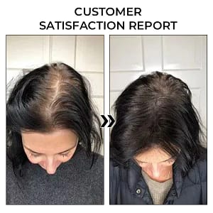 Fivfivgo™ BeeGrow Follicle Reviving Hair Essence