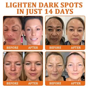 Flysmus Botox Bee Venom Treatment Serum Stick
