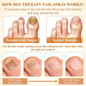 Fivfivgo® Fungiclear Bee Therapy Nail Spray