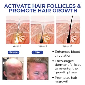 Fivfivgo™ BeeGrow Follicle Reviving Hair Essence