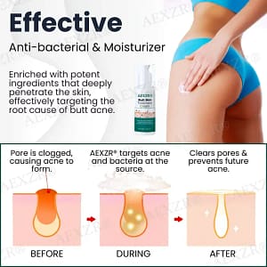 AEXZR® Butt Skin Treatment Cream