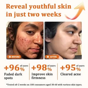 Flysmus Botox Bee Venom Treatment Serum Stick