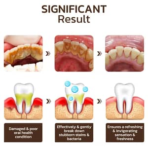Fivfivgo™ Niacinamide Whitening Toothpaste