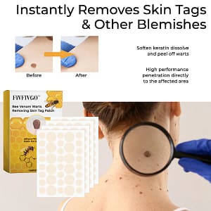 Fivfivgo™ Bee Venom Warts Removing Skin Tag Patch