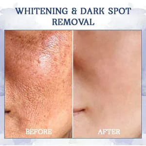 Fivfivgo™ Advanced Firming & Wrinkle-Reducing Cream