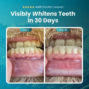 Larineco™️ – Remineralizing Gum