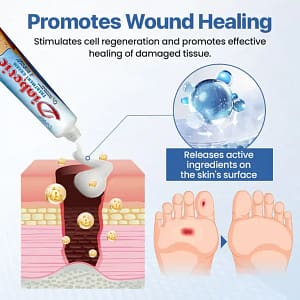 CVREOZ® VitaGluco Diabetes Treatment Cream