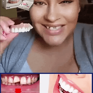 Hidone® Advanced Customized Full Denture Set