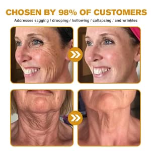APKAPK™ Bee Venom Skin Treatment Cream