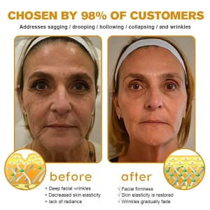 APKAPK™ Bee Venom Skin Treatment Cream