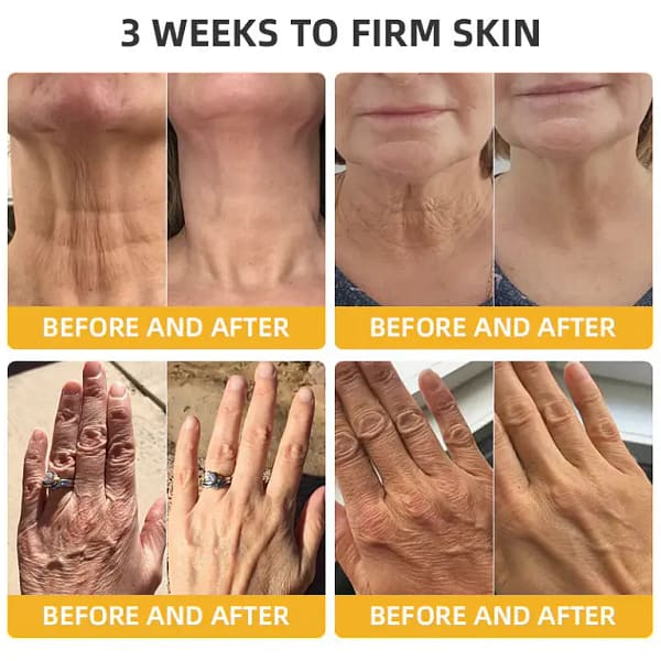Fivfivgo™ BeeLift Anti-Ageing Firming Cream