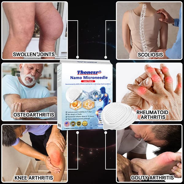 Thonesr® Nano-microneedle joint patch