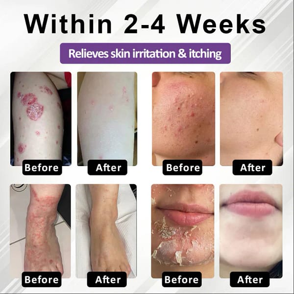 Fivfivgo® Purple Corn Multi-Condition Skin Spray
