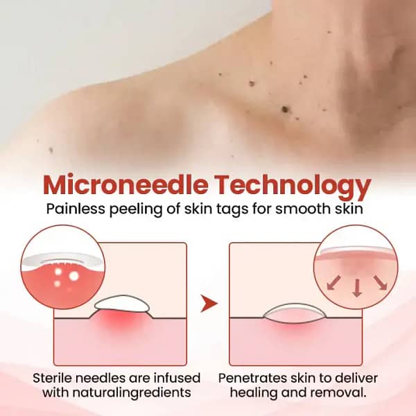 Biancat® TagDrop Painless Micro Patch