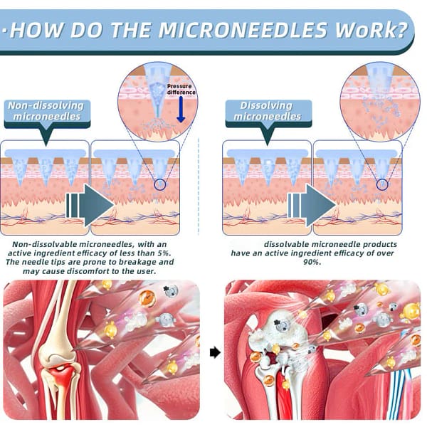 Fivfivgo® Nano-Microneedle Joint Patch