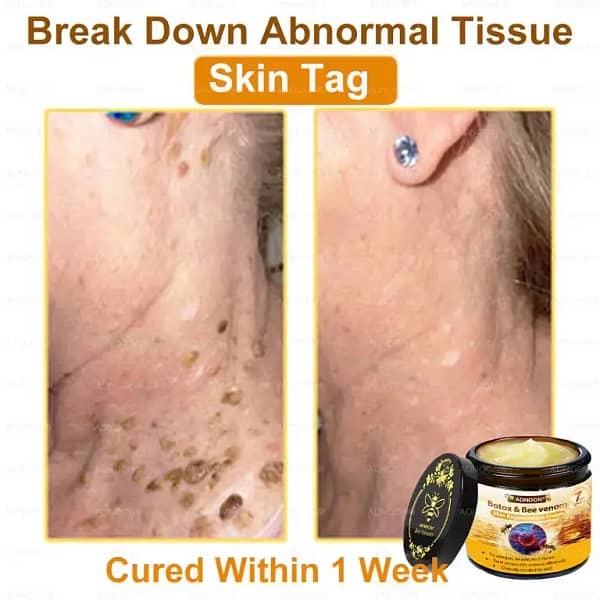 ADNOON™ Botox & Bee Venom Skin Treatment Cream