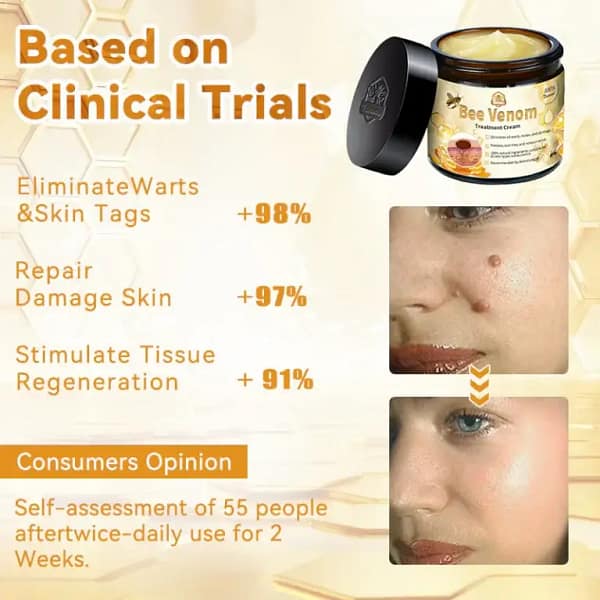 Turonu™ Bee Venom Treatment Cream